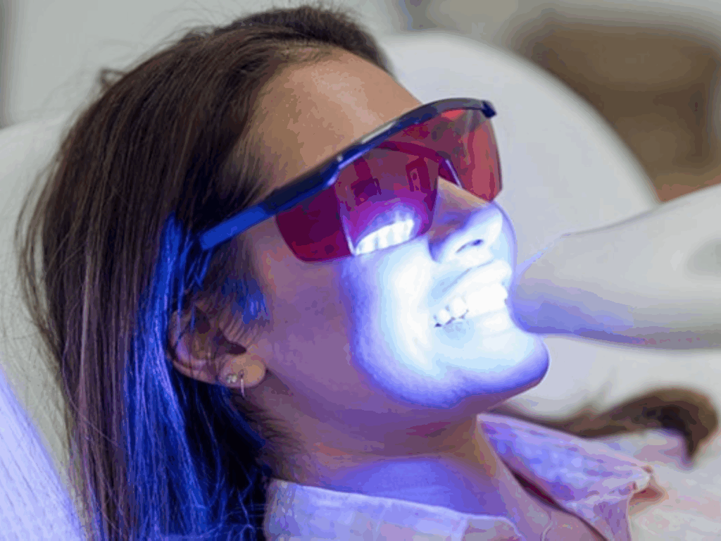 Different Teeth Whitening Treatment Options
