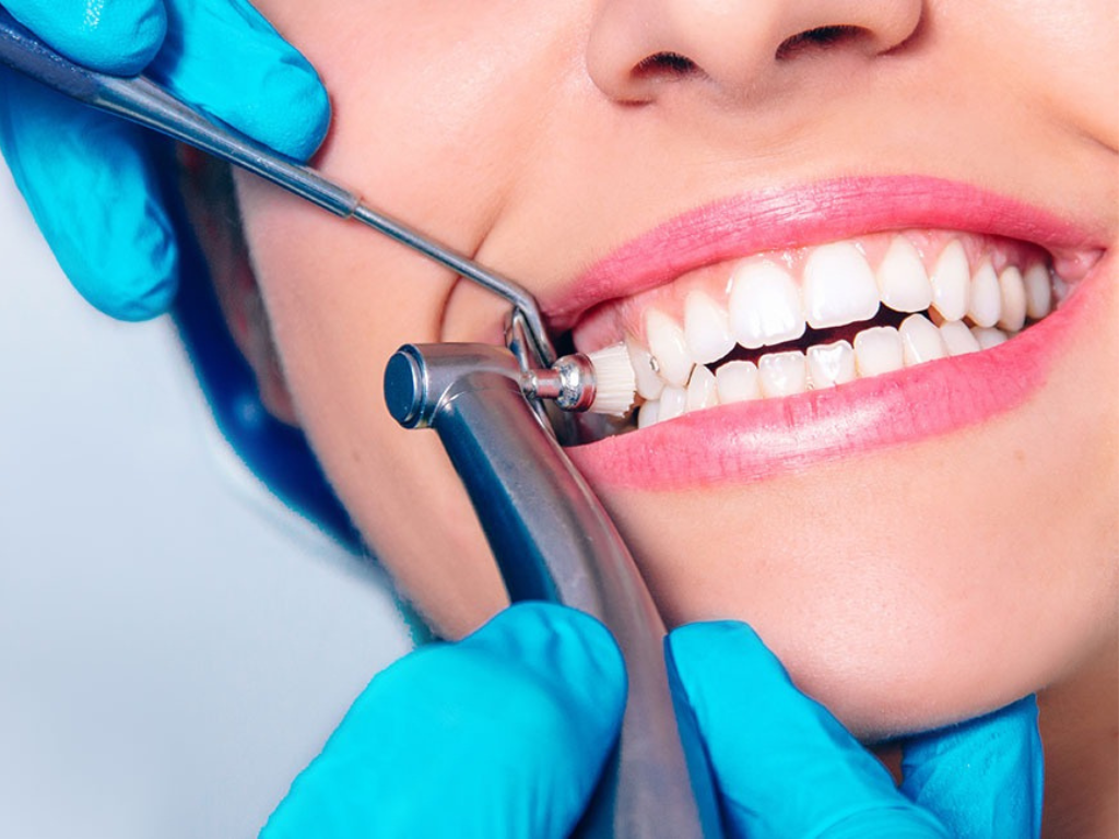Why Regular Teeth Cleaning is Important